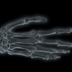 Röntgen_Sebastian Knopf_www_jugendfotos_de, CC-Lizenz(by-nc-nd)